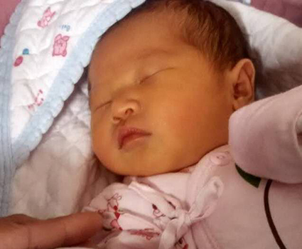 宝宝黄疸反复是正常的吗？