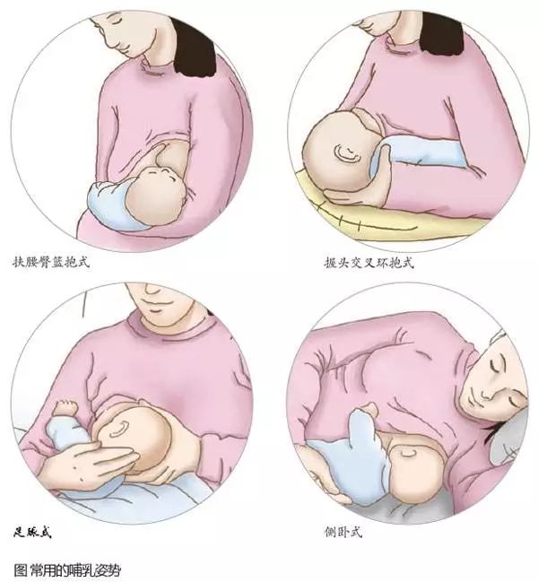 乳腺炎能不能喂奶？